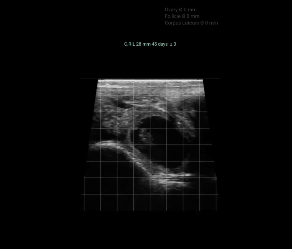 Bringing Fertility and Pregnancy into Focus: The Latest from IMV Technologies’ BovIntel