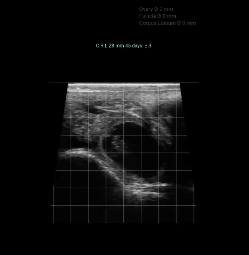 Bringing Fertility and Pregnancy into Focus: The Latest from IMV Technologies’ BovIntel